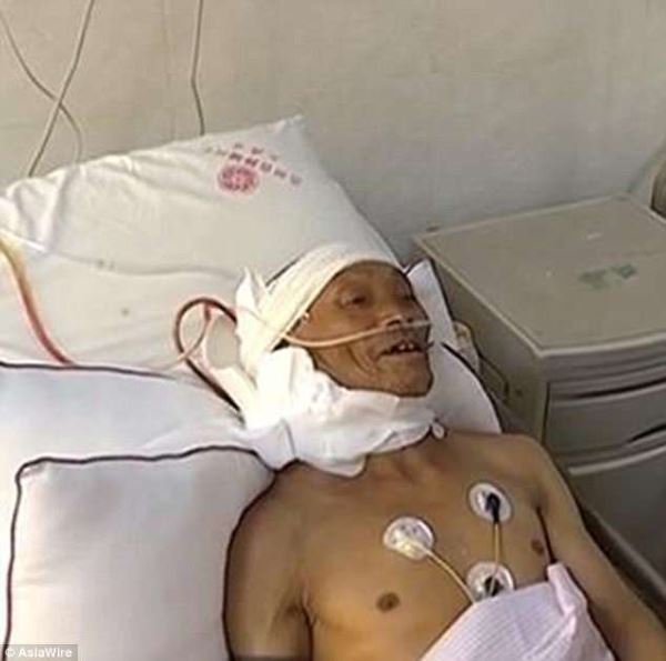 Китаец 47 лет "выращивал" на своей шее 15-килограммовую опухоль