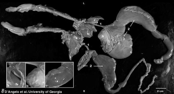 Житель Миннесоты пошел в лес за грибами, а нашел двухголового олененка