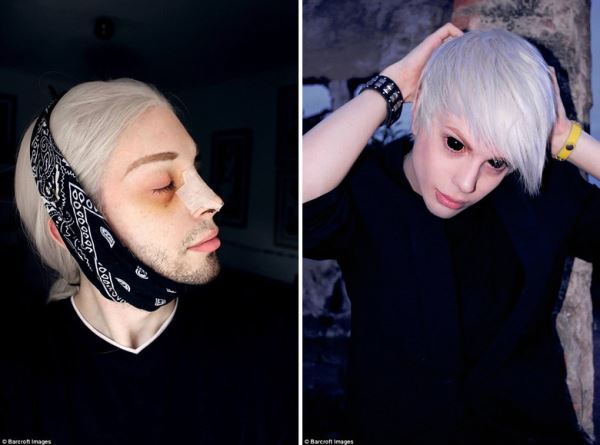 Ставший "эльфом" аргентинец решил удалить кадык и вживить клыки