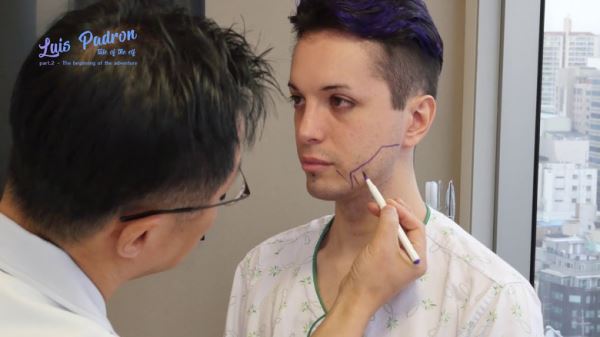 Ставший "эльфом" аргентинец решил удалить кадык и вживить клыки