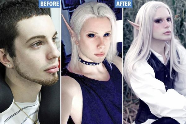 Ставший "эльфом" аргентинец решил удалить кадык и вживить клыки